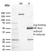 CD117/c-Kit (Marker for Gastrointestinal Stromal Tumors) Antibody in SDS-PAGE (SDS-PAGE)