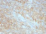 CD117/c-Kit (Marker for Gastrointestinal Stromal Tumors) Antibody in Immunohistochemistry (Paraffin) (IHC (P))