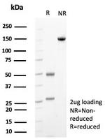 CD117/c-Kit (Marker for Gastrointestinal Stromal Tumors) Antibody in SDS-PAGE (SDS-PAGE)