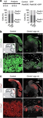 PAX3 Antibody in Immunohistochemistry (Paraffin) (IHC (P))