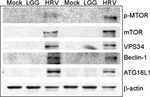 VPS34 Antibody in Western Blot (WB)