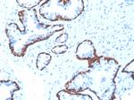 Cytokeratin 5 (KRT5) Antibody in Immunohistochemistry (Paraffin) (IHC (P))