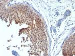 Cytokeratin 6 (Basal Cell Marker) Antibody in Immunohistochemistry (Paraffin) (IHC (P))