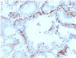 Cytokeratin 6A (KRT6A) (Basal Cell Marker) Antibody in Immunohistochemistry (Paraffin) (IHC (P))