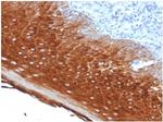 Cytokeratin 6A (KRT6A) (Basal Cell Marker) Antibody in Immunohistochemistry (Paraffin) (IHC (P))