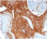 Cytokeratin 6A (KRT6A) (Basal Cell Marker) Antibody in Immunohistochemistry (Paraffin) (IHC (P))