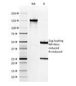 Cytokeratin 6A (KRT6A) (Basal Cell Marker) Antibody in SDS-PAGE (SDS-PAGE)