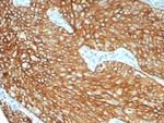 Cytokeratin 6/KRT6 (Pan; a,b,c) (Basal Cell Marker) Antibody in Immunohistochemistry (Paraffin) (IHC (P))