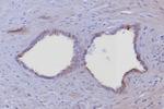 Cytokeratin 6/KRT6 (Pan; a,b,c) (Basal Cell Marker) Antibody in Immunohistochemistry (Paraffin) (IHC (P))