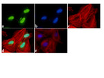 IRAK1 Antibody in Immunocytochemistry (ICC/IF)