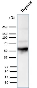 Cytokeratin 10 (KRT10) (Suprabasal Epithelial Marker) Antibody in Western Blot (WB)