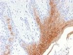 Cytokeratin 10 (KRT10) (Suprabasal Epithelial Marker) Antibody in Immunohistochemistry (Paraffin) (IHC (P))