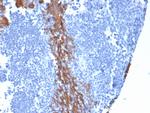 Cytokeratin 13 (Non-Keratinized Squamous Epithelial Marker) Antibody in Immunohistochemistry (Paraffin) (IHC (P))