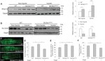 BMPR1A Antibody in Western Blot (WB)