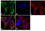 BMPR1A Antibody in Immunocytochemistry (ICC/IF)