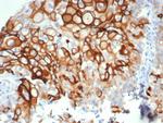 Cytokeratin 14 (KRT14) (Squamous Cell Marker) Antibody in Immunohistochemistry (Paraffin) (IHC (P))