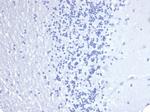 Cytokeratin 14 (KRT14) (Squamous Cell Marker) Antibody in Immunohistochemistry (Paraffin) (IHC (P))