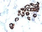 Cytokeratin 15 (Esophageal Squamous Cell Carcinoma Marker) Antibody in Immunohistochemistry (Paraffin) (IHC (P))