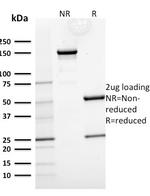 Cytokeratin 15 (Esophageal Squamous Cell Carcinoma Marker) Antibody in SDS-PAGE (SDS-PAGE)