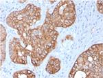 Cytokeratin 15 (Esophageal Squamous Cell Carcinoma Marker) Antibody in Immunohistochemistry (Paraffin) (IHC (P))