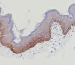 Cytokeratin 15 (Esophageal Squamous Cell Carcinoma Marker) Antibody in Immunohistochemistry (Paraffin) (IHC (P))