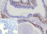 Cytokeratin 15 (Esophageal Squamous Cell Carcinoma Marker) Antibody in Immunohistochemistry (Paraffin) (IHC (P))