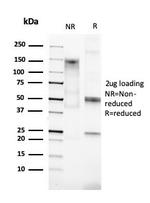 Cytokeratin 15 (Esophageal Squamous Cell Carcinoma Marker) Antibody in SDS-PAGE (SDS-PAGE)