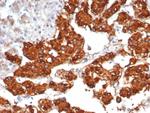 Interleukin-31/IL-33 Antibody in Immunohistochemistry (Paraffin) (IHC (P))