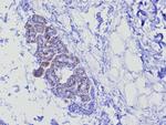 Cytokeratin 17 (CK17) (Basal Epithelial Marker) Antibody in Immunohistochemistry (Paraffin) (IHC (P))