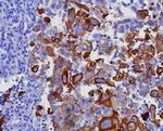 Cytokeratin 17 (CK17) (Basal Epithelial Marker) Antibody in Immunohistochemistry (Paraffin) (IHC (P))