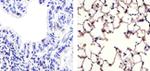 Claudin 18 Antibody in Immunohistochemistry (Paraffin) (IHC (P))