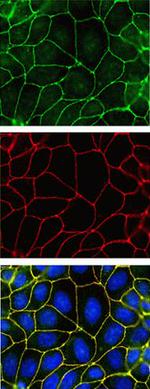 ZO-2 Antibody in Immunocytochemistry (ICC/IF)