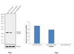 Galectin 3 Antibody