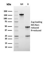 Lymphocyte Activation Gene 3 (LAG-3) (Negative Checkpoint Regulator) Antibody in SDS-PAGE (SDS-PAGE)