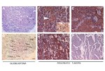 PPAP2B Antibody in Immunohistochemistry (IHC)