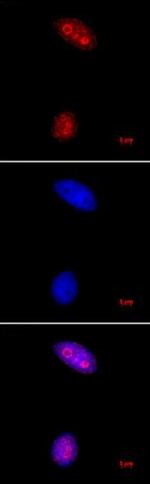 Histone H3K27me3 Antibody in Immunocytochemistry (ICC/IF)