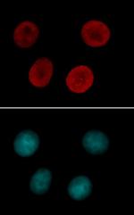 Histone H4K12ac Antibody in Immunocytochemistry (ICC/IF)