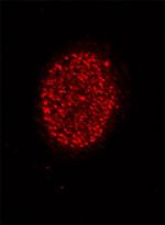 Histone H4K5ac Antibody in Immunocytochemistry (ICC/IF)