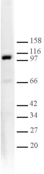 L3MBTL1 Antibody in Western Blot (WB)