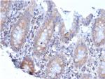 Laminin Receptor/ RPSA (Marker of Metastatic Potential) Antibody in Immunohistochemistry (Paraffin) (IHC (P))