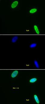Histone H3K9me2 Antibody in Immunocytochemistry (ICC/IF)