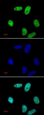 Histone H3K27me2 Antibody in Western Blot (WB)