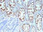 Stathmin 1/STMN1 Antibody in Immunohistochemistry (Paraffin) (IHC (P))