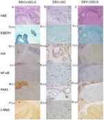 AID Antibody in Immunohistochemistry (IHC)