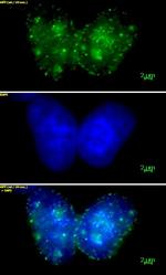 Histone H3K9me3 Antibody in Immunocytochemistry (ICC/IF)