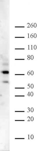 Ikaros Antibody in Western Blot (WB)