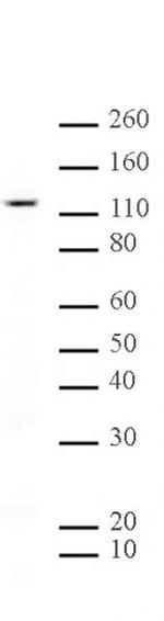 SIRT1 Antibody in Western Blot (WB)