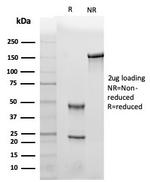 Leptin Receptor (LEPR)/Ob-R/CD295 Antibody in SDS-PAGE (SDS-PAGE)