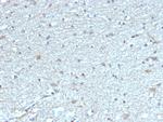 Leptin Receptor (LEPR)/Ob-R/CD295 Antibody in Immunohistochemistry (Paraffin) (IHC (P))