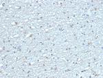 Leptin Receptor (LEPR)/Ob-R/CD295 Antibody in Immunohistochemistry (Paraffin) (IHC (P))